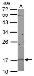Anti-p19 INK4d antibody used in Western Blot (WB). GTX102414